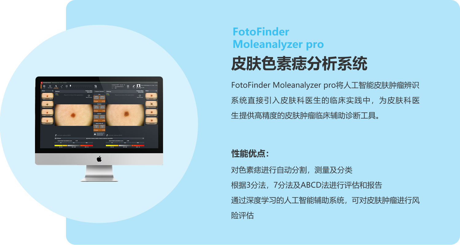 FotoFinder，Moleanalyzer pro，皮肤色素痣分析系统，恩泰，皮肤镜，人工智能，良恶性辨识