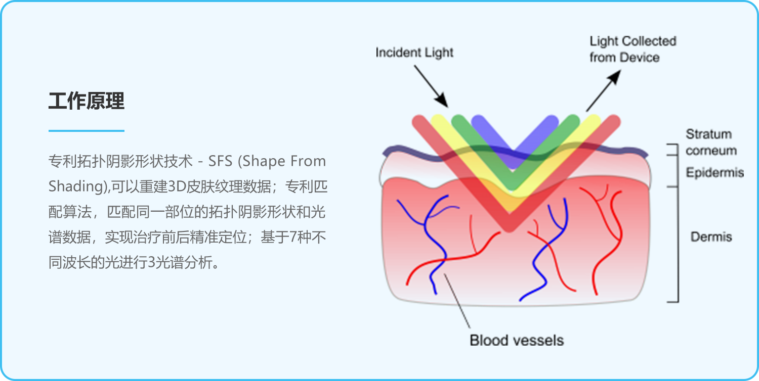 Antera 3D，Miravex，恩泰，皮肤肤质3D成像，3D相机，皱纹，纹理，毛孔，疤痕，黑色素，血红素检测
