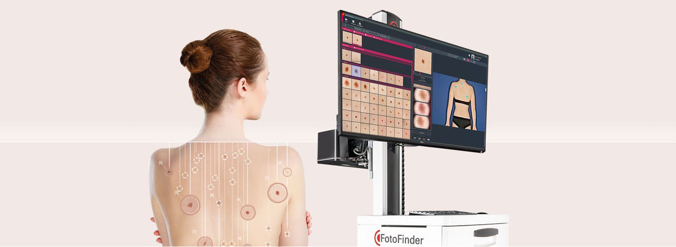 FotoFinder，ATBM，FotoFinder bodystudio ATBM，Dermoscope，恩泰，皮肤镜，数字皮肤镜，德国皮肤镜